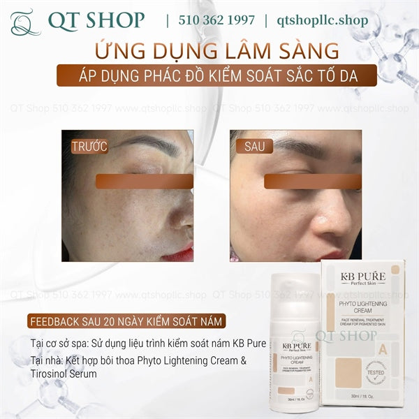 KB PURE - Phyto Cream - Kem Trị Nám Trắng Da - 30ml