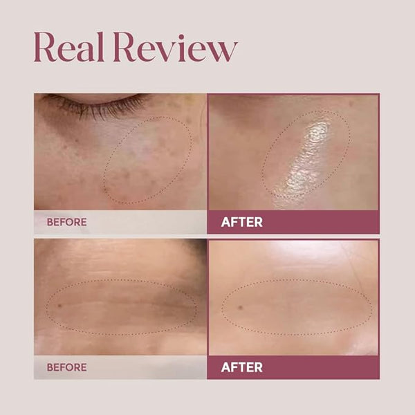 Kem Dưỡng Tái Tạo Tế Bào Reborn Cream NK Cell Lulubeu