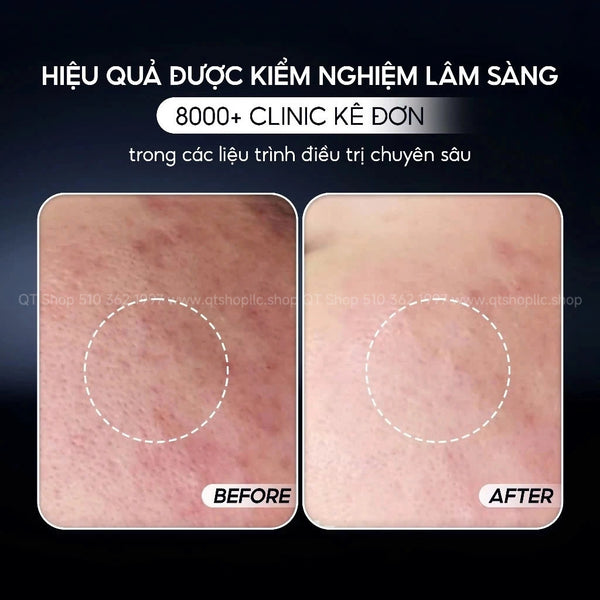 Pharmesthetics CONAPIDIL Gel Starter 200ml - Toner Tinh Chất Dưỡng Sơ Cấp