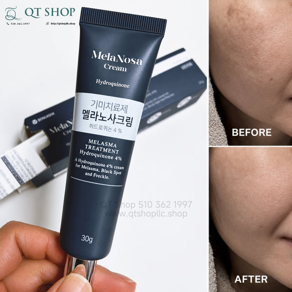 Kem Melasma Treatment Hydroquinone 4% - MelaNosa Cream 30g