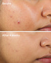 ACNE - Kem Dưỡng Ẩm Dạng Gel Mỏng Nhẹ Cho Da Dầu Mụn Murad Clarifying Water Gel
