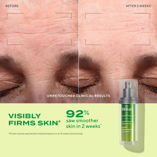 Tinh Chất Retinol Giúp Da Mịn Màng Và Làm Mờ Nếp Nhăn Murad Retinol Youth Renewal Serum