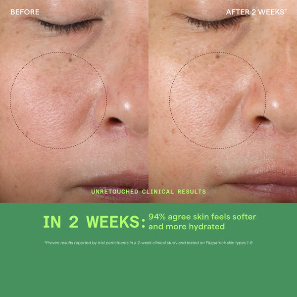 Tinh Chất Hỗ Trợ Sáng Da, Làm Đều Màu Da Murad Vita-C Glycolic Serum