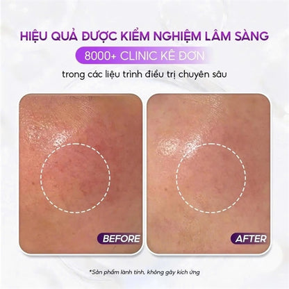 Pharmesthetics - Conapidil Cemenphalt Modeling Mask - Mặt Nạ Dẻo Phục Hồi- 5 miếng