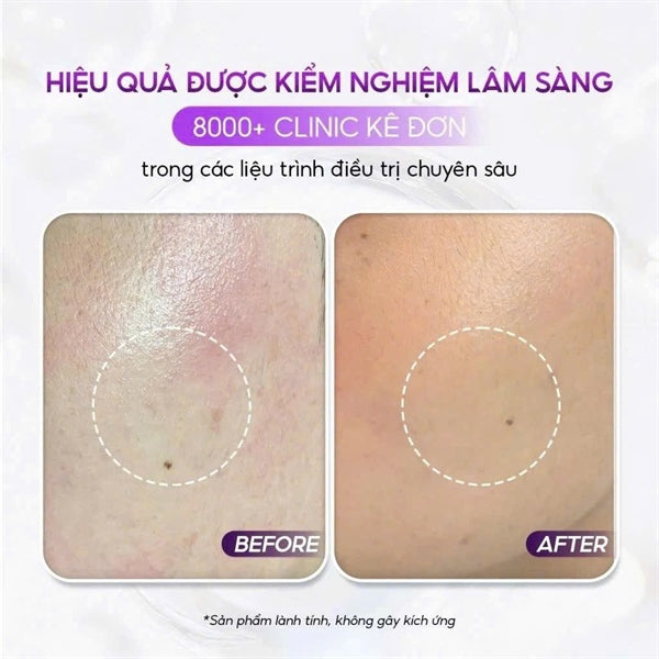 Pharmesthetics - Conapidil Lotion Polishing 200ml - Dầu tẩy trang