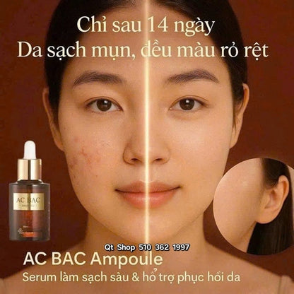 Serum trị mụn AC BAC - EXP 202705
