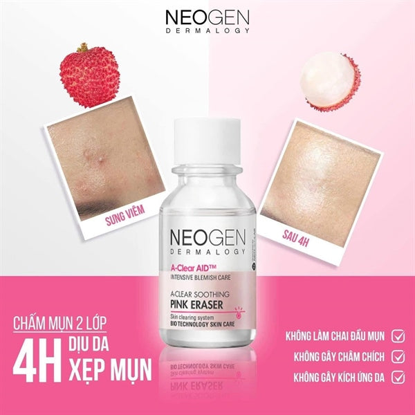 Chấm Mụn Neogen 15ml - Exp 20280415