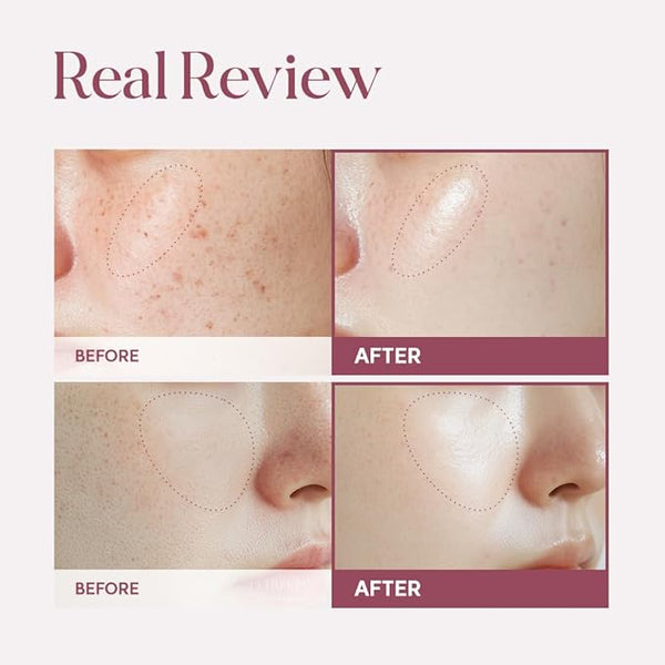 Xịt Khoáng Giúp Cân Bằng,Dưỡng Ẩm Và Săn Chắc Da Active Booster NK Cell Lulubeu