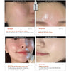Tinh Chất Men Vi Sinh PURCELL Pixcell Biom 2 Billion/mL