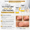 DocLab - ABP Solution Ampoule V2: TBG đặc trị mụn - 5ea