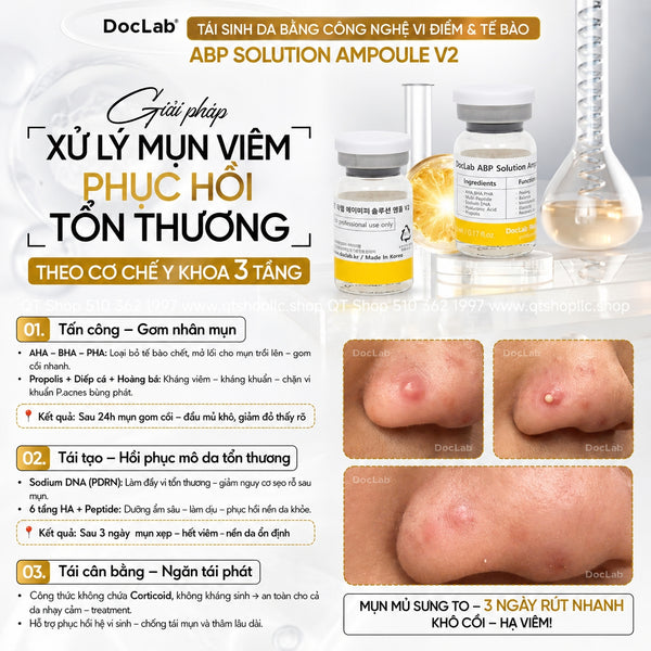 DocLab - ABP Solution Ampoule V2: TBG đặc trị mụn - 5ea