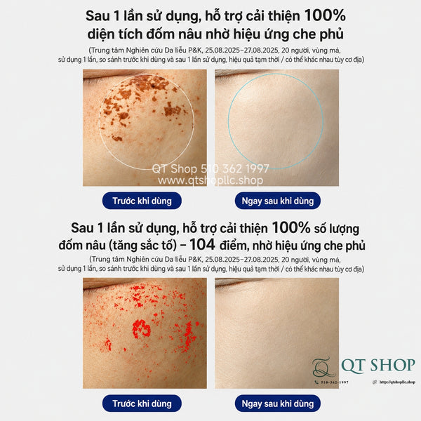 Kem Đa Năng EARTHERA Exocell-3 X-Toning Blemish Corrector - 30ml