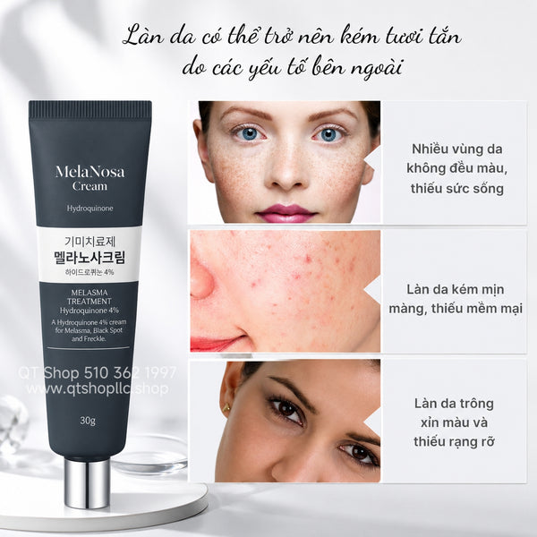 Kem Melasma Treatment Hydroquinone 4% - MelaNosa Cream 30g