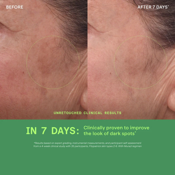 Tinh Chất Làm Mờ Vết Nám Và Giảm Sự Hình Thành Đốm Nâu Murad Rapid Dark Spot Correcting Serum