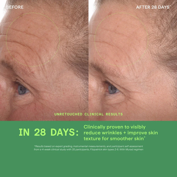 Tinh Chất Làm Mờ Vết Nám Và Giảm Sự Hình Thành Đốm Nâu Murad Rapid Dark Spot Correcting Serum