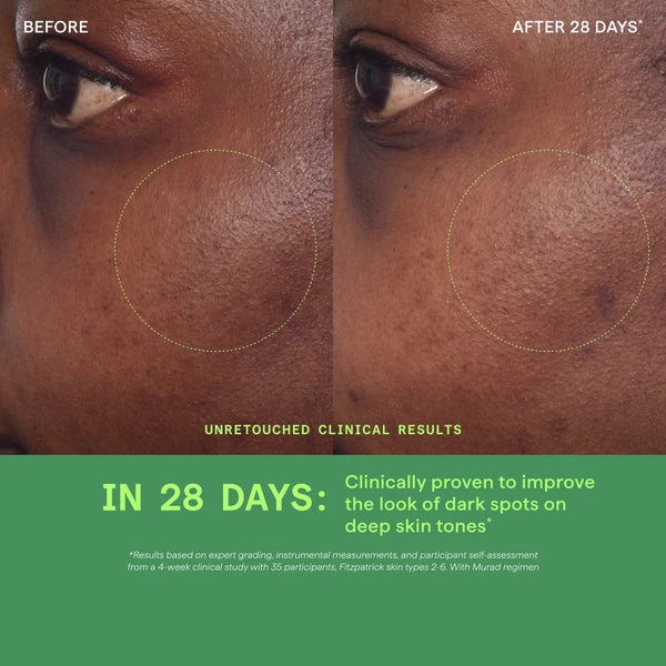 Tinh Chất Làm Mờ Vết Nám Và Giảm Sự Hình Thành Đốm Nâu Murad Rapid Dark Spot Correcting Serum