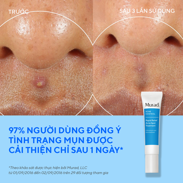 ACNE - Gel chấm mụn Murad Rapid Relief Acne Treatment