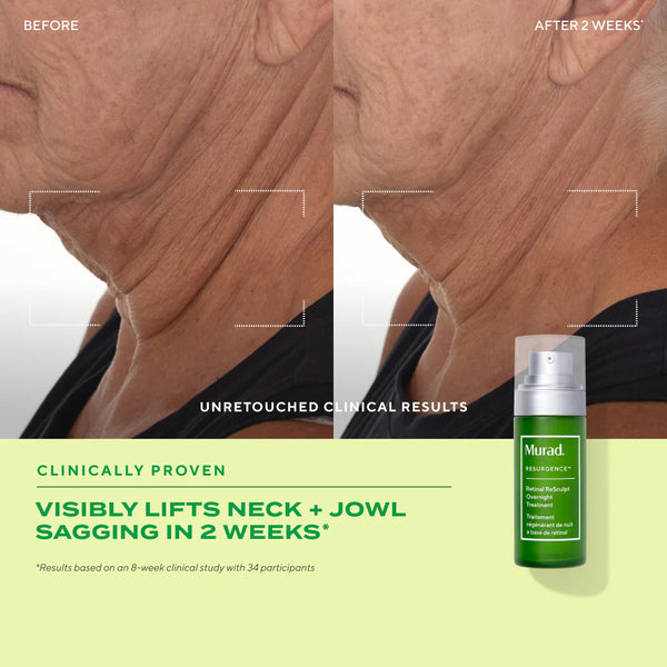 Tinh Chất Retinal Giúp Cải Thiện Độ Đàn Hồi Cho Da Murad Retinal ReSculpt Overnight Treatment