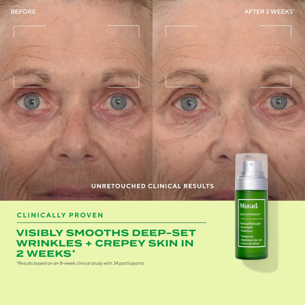 Tinh Chất Retinal Giúp Cải Thiện Độ Đàn Hồi Cho Da Murad Retinal ReSculpt Overnight Treatment