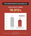 Peel Tái Tạo Làn Da Sáng Mịn, Đều Màu - Double Peel OxygenCeuticals