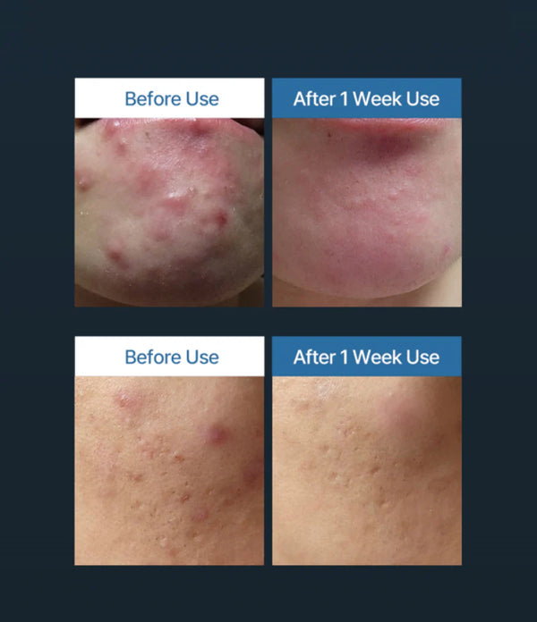 I Fill Toner Pad OxygenCeuticals