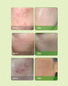 Kem Dưỡng Da Phiên Bản Đặc Biệt - Skin Barrier Ato OxygenCeuticals