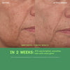 Tinh Chất Hỗ Trợ Sáng Da, Làm Đều Màu Da Murad Vita-C Glycolic Serum