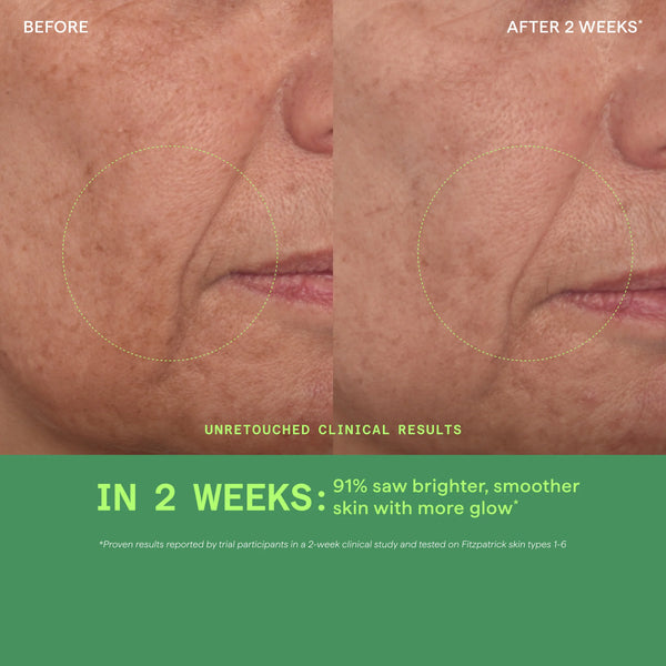 Tinh Chất Hỗ Trợ Sáng Da, Làm Đều Màu Da Murad Vita-C Glycolic Serum