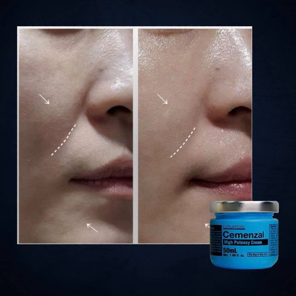 Pharmesthetics - CONAPIDIL Cemenzal High Potency Cream - Kem Tái Định Vị (Ban Đêm) 50g - EXP 202812