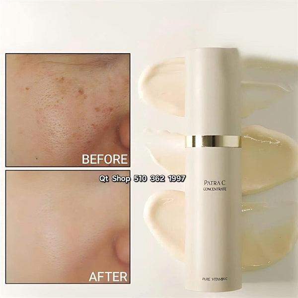 Tinh Chất Vitamin C - Costalgia - 15ml - EXP 202803
