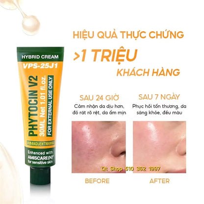 Pharmesthetics - VQM Kem Phục Hồi Phytocin V2 - EXP 20280316