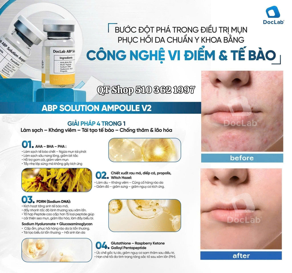 DocLab - ABP Solution Ampoule V2: TBG đặc trị mụn - 5ea